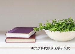 牛皮癣治疗有哪些原则要遵循
