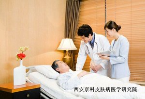 怎样治疗牛皮癣才有效