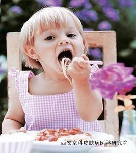 牛皮癣患者的饮食有何讲究