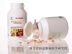 牛皮癣病人如何自我识别