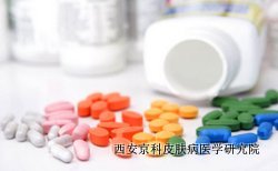 牛皮癣要怎么预防才好