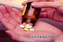 护理初期牛皮癣注意事项