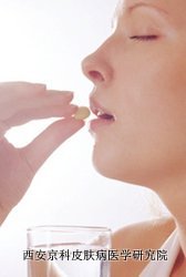怎样预防牛皮癣