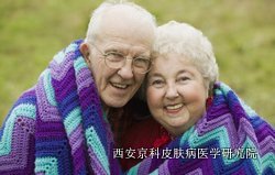 该怎么治疗老年牛皮癣呢