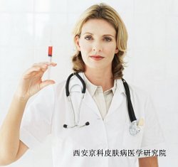 男性牛皮癣是哪些造成的