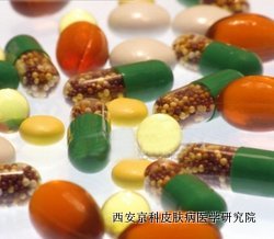 牛皮癣的偏方有哪些